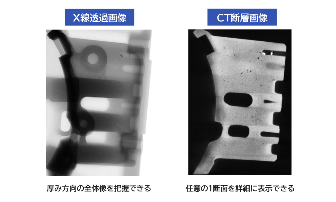 X線透過画像とCT断層画像の比較
